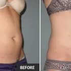 Business 18 image ST LOUIS LASER VEIN CENTER in St. Louis MO