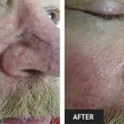 Business 22 image ST LOUIS LASER VEIN CENTER in St. Louis MO