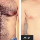 Business 24 image ST LOUIS LASER VEIN CENTER in St. Louis MO