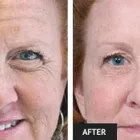 Business 25 image ST LOUIS LASER VEIN CENTER in St. Louis MO