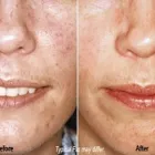 Business 26 image ST LOUIS LASER VEIN CENTER in St. Louis MO