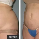 Business 36 image ST LOUIS LASER VEIN CENTER in St. Louis MO