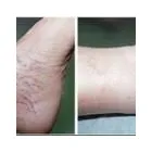 Business 44 image ST LOUIS LASER VEIN CENTER in St. Louis MO