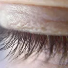 Business 46 image ST LOUIS LASER VEIN CENTER in St. Louis MO