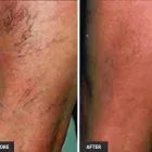 Business 53 image ST LOUIS LASER VEIN CENTER in St. Louis MO