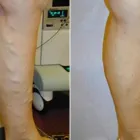 Business 56 image ST LOUIS LASER VEIN CENTER in St. Louis MO