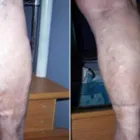 Business 59 image ST LOUIS LASER VEIN CENTER in St. Louis MO