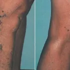 Business 64 image ST LOUIS LASER VEIN CENTER in St. Louis MO