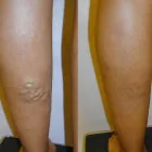 Business 68 image ST LOUIS LASER VEIN CENTER in St. Louis MO