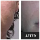 Business 69 image ST LOUIS LASER VEIN CENTER in St. Louis MO