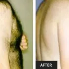 Business 70 image ST LOUIS LASER VEIN CENTER in St. Louis MO