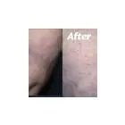 Business 71 image ST LOUIS LASER VEIN CENTER in St. Louis MO