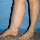 Business 79 image ST LOUIS LASER VEIN CENTER in St. Louis MO