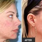 Business 87 image ST LOUIS LASER VEIN CENTER in St. Louis MO