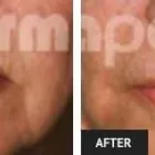 Business 88 image ST LOUIS LASER VEIN CENTER in St. Louis MO
