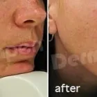 Business 89 image ST LOUIS LASER VEIN CENTER in St. Louis MO