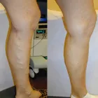 Business 98 image ST LOUIS LASER VEIN CENTER in St. Louis MO