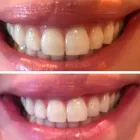 Business 2 image STAY POLISHED Teeth Whitening Service in Danville CA