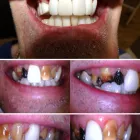 Business 2 image TAYANI DENTAL GROUP Dentist in Fullerton CA