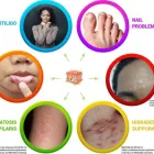 Business 1 image THE CENTER FOR INTEGRATIVE & NATUROPATHIC DERMATOLOGY INC Health & Medicine in Los Angeles CA