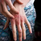 Business 2 image THE CENTER FOR INTEGRATIVE & NATUROPATHIC DERMATOLOGY INC Health & Medicine in Los Angeles CA