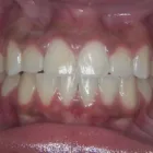 Business 6 image THOMAS L MUNHOLLAND DDS PC Orthodontists in Aurora CO