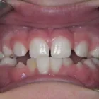 Business 1 image THOMAS L MUNHOLLAND DDS PC Orthodontists in Aurora CO