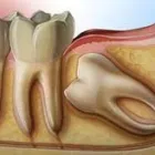 Business 11 image TODAYS DENTISTRY LEAGUE CITY Oral & Maxillofacial Surgeons in League City TX