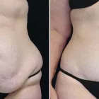 Business 2 image TULSA PLASTIC SURGERY Physicians & Surgeons, Surgery-General in Tulsa OK