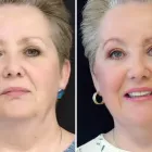 Business 6 image TULSA PLASTIC SURGERY Physicians & Surgeons, Surgery-General in Tulsa OK