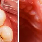 Business 1 image TULSA PREMIER DENTISTRY Prosthodontists, Endodontists & Periodontists in Tulsa OK