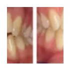 Business 2 image TULSA PREMIER DENTISTRY Prosthodontists, Endodontists & Periodontists in Tulsa OK