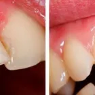Business 3 image TULSA PREMIER DENTISTRY Prosthodontists, Endodontists & Periodontists in Tulsa OK