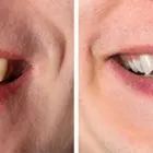 Business 4 image TULSA PREMIER DENTISTRY Prosthodontists, Endodontists & Periodontists in Tulsa OK