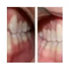 Business 5 image TULSA PREMIER DENTISTRY Prosthodontists, Endodontists & Periodontists in Tulsa OK