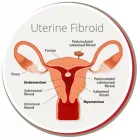 Business 3 image USA FIBROID CENTERS Clinics in Bronx NY