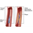 Business 1 image USA VASCULAR CENTERS in Fort Worth TX