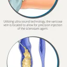 Business 6 image USA VEIN CLINICS IN ARCHER AVE. CHICAG Vein Doctor in Chicago IL