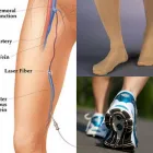 Business 3 image USA VEIN CLINICS IN ARCHER AVE. CHICAG Vein Doctor in Chicago IL