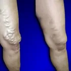 Business 2 image USA VEIN CLINICS Vein Doctor in Staten Island NY