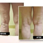 Business 3 image USA VEIN CLINICS Vein Doctor in Staten Island NY