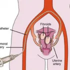 Business 1 image USA VEIN CLINICS Vascular Surgeons in Bronx NY