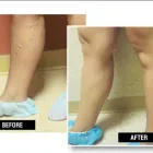 Business 3 image USA VEIN CLINICS Vein Doctor in Bellevue WA