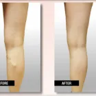 Business 1 image USA VEIN CLINICS Vein Doctor in Staten Island NY
