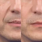 Business 1 image VAMPIRE FACELIFT in New York NY
