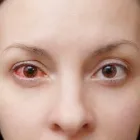 Business 40 image WICKER PARK EYE CENTER in Chicago IL