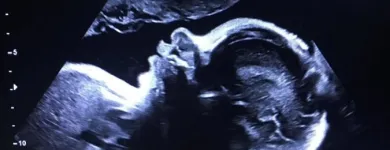 Business 1 image BEFORE WE MEET LLC Radiology & Medical Imaging in King Of Prussia PA
