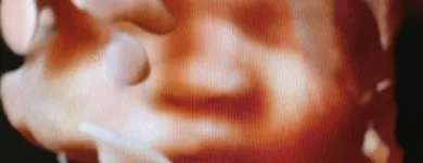 Business 2 image BEFORE WE MEET LLC Radiology & Medical Imaging in King Of Prussia PA