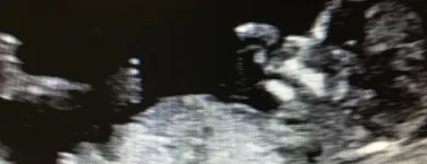 Business 5 image BEFORE WE MEET LLC Radiology & Medical Imaging in King Of Prussia PA
