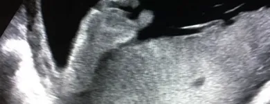 Business 10 image BEFORE WE MEET LLC Radiology & Medical Imaging in King Of Prussia PA